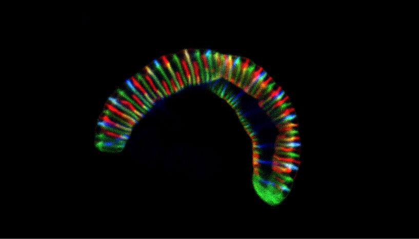 Abb.1: Microscope image of the bacterium