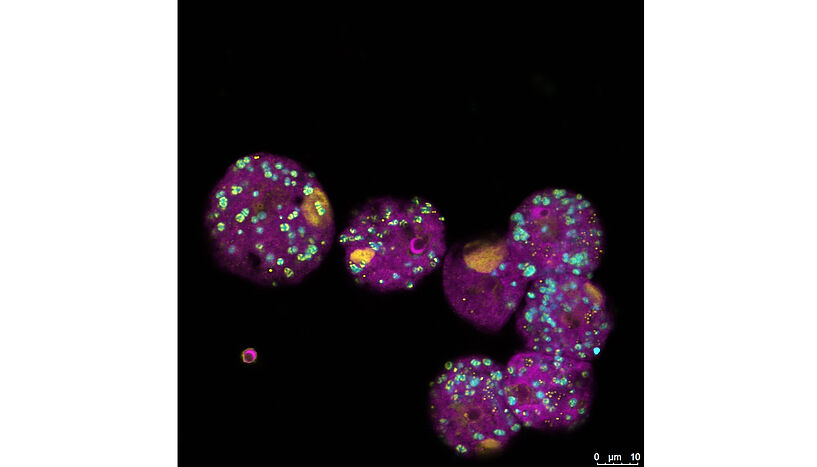 Abb. 1: FISH image shows amoeba infected with Viennavirus and the bacterial symbiont