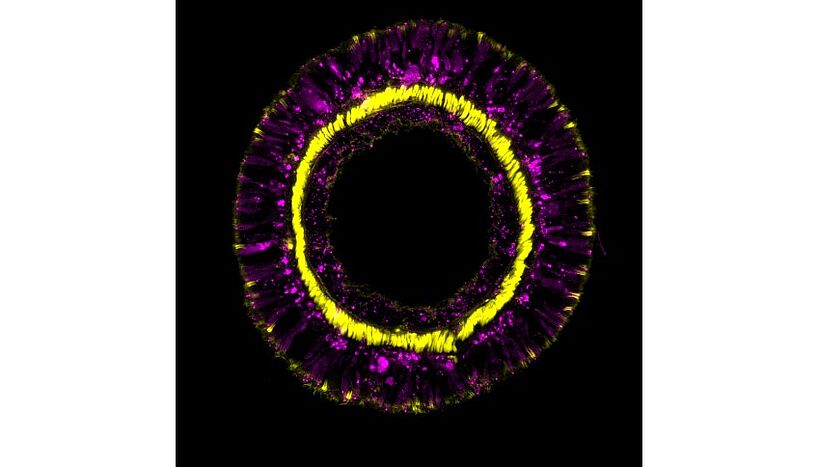 Abb. 1 : Querschnitt durch einen Tentakel einer transgenen Seeanemone, die Differenzierungsprodukte der SoxC Zellpopulation (magenta) zeigt und Retraktormuskeln (gelb).