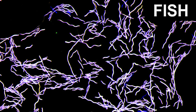 Abb. 1: Fluoreszenzmikroskopisches Bild von Taurinivorans muris in Reinkultur