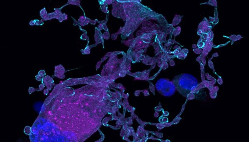 Membrane-dependent proplatelet formation. Platelet-producing Megakaryocyte. Copyright: Oliver Borst, Tübingen.