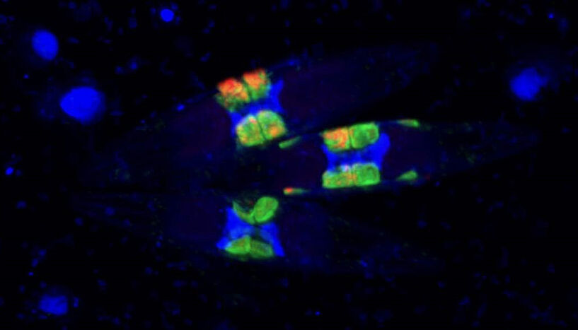 Fig. 3: A group of diatoms with their fluorescently-labeled symbionts