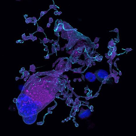 Membrane-dependent proplatelet formation. Platelet-producing Megakaryocyte. Copyright: Oliver Borst, Tübingen.