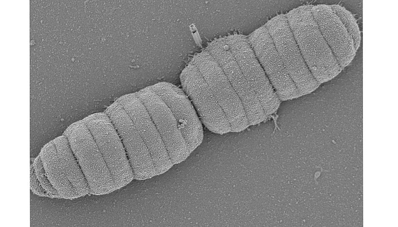 Abb.2: Scanning electron micrograph of the bacterium