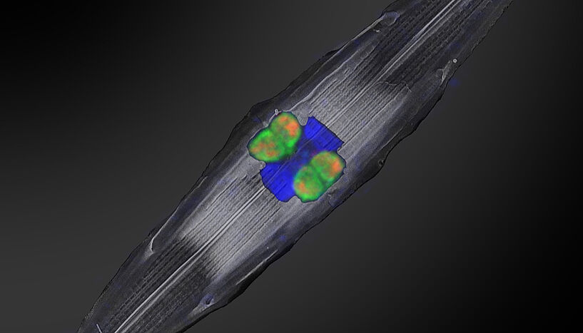 Fig. 1: The nucleus of the diatom in bright blue
