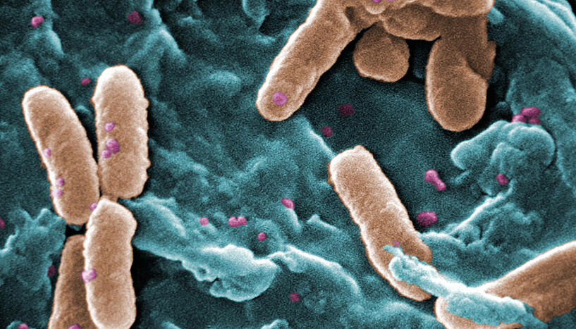 Abbildung von Pseudomonas aeruginosa unter den Mikroskop