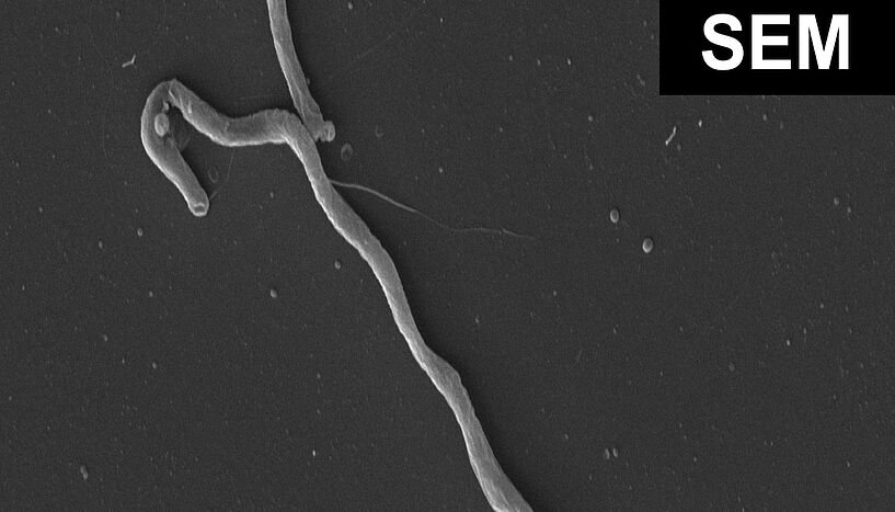 Fig. 2: Electron microscopy of Taurinivorans muris in pure culture