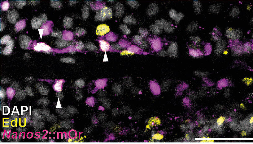 Abb. 2: Eine laser scanning confokale fluoreszenz-mikroskopische Aufnahme aus dem Körper der Seeanemone Nematostella vectensis. In Rot (Nanos2) sind die transgenen putativen Stammzellen markiert, in Weiß (DAPI) alle Zellkerne und in Gelb (EdU) die Zellen, die sich gerade in der DNA-Synthese eines aktiven Zellzyklus befinden. Die Pfeile deuten auf Stammzellen hin, die sich gerade im aktiven Zellzyklus befinden.